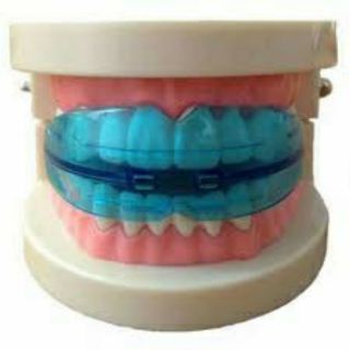 Dụng cụ niềng răng tại nhà