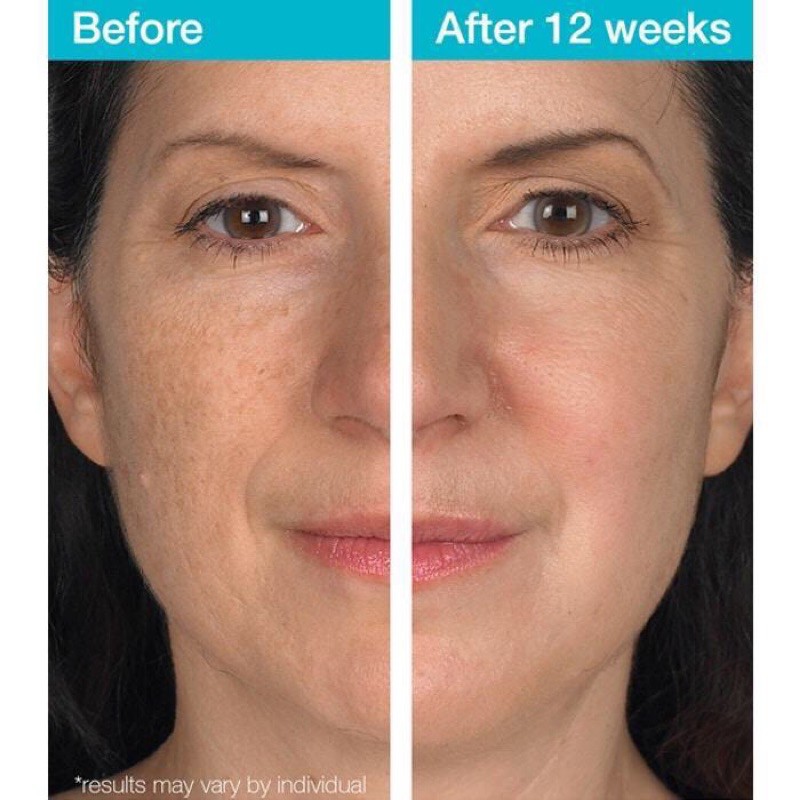 [Hàng Mỹ]Tinh Chất làm mờ nếp nhăn Olay Wrinkle Serum Max Fragrance Free 40ml
