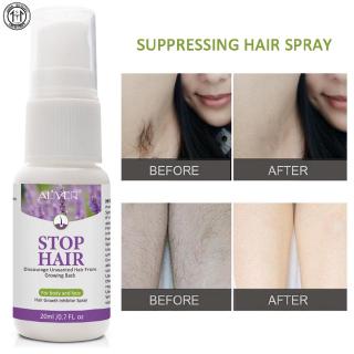 Thuốc xịt ức chế mọc lông TIME ALIVER 20ml