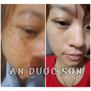 Serum An Dược Sơn chai 50ml