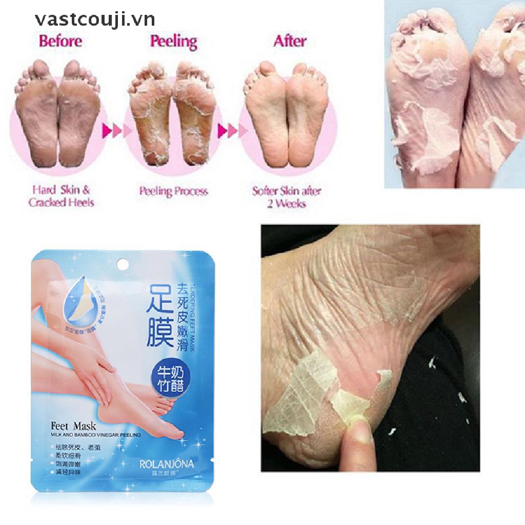 1 Cặp Mặt Nạ Chân Tẩy Tế Bào Chết Da Chân VASTJI