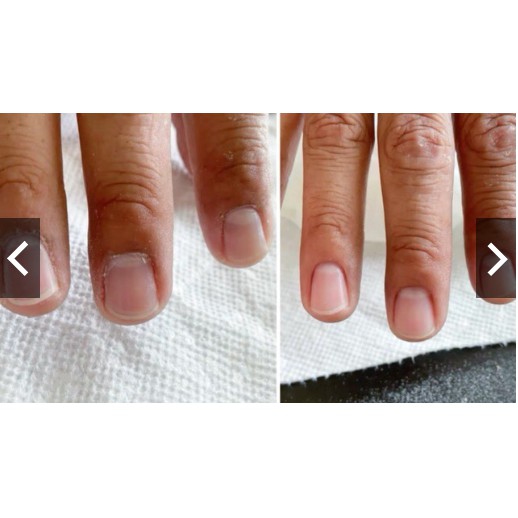 Mềm da mỹ [Hàng chính hãng] nước mềm da ko cần ngâm | BigBuy360 - bigbuy360.vn