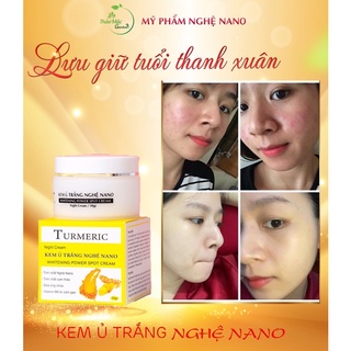KEM Ủ TRẮNG NGHỆ