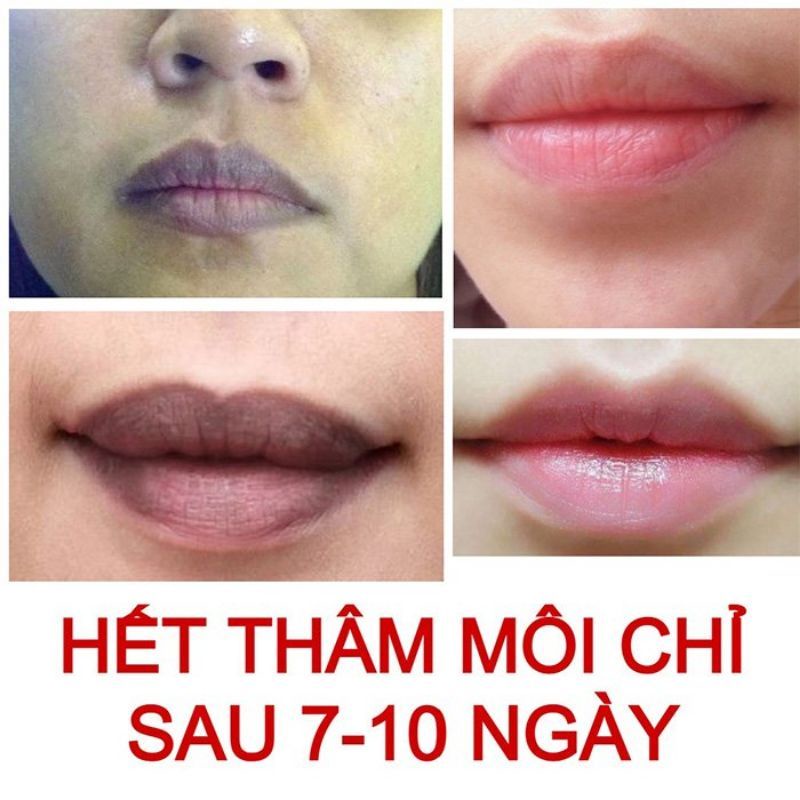 [Freeship Toàn Quốc] Tẩy Thâm Môi Collagen Thiên Di Dưỡng Môi Hồng Tự Nhiên Giúp Môi Luôn Hồng Hào Lọ 8Gr Date 2024