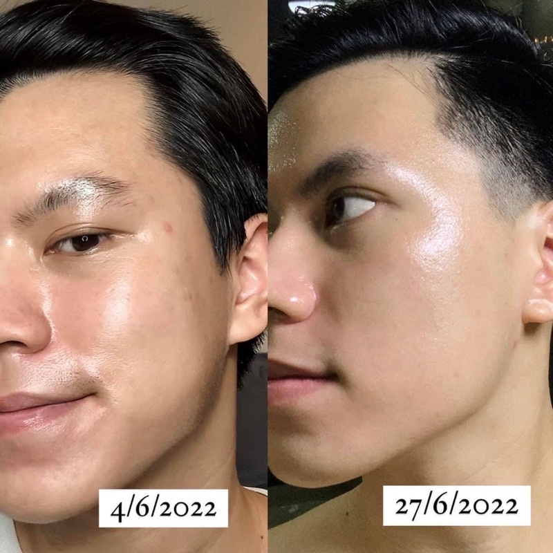 Serum Oh! Oh! Niacinamide 20% dưỡng sáng da, giảm thâm nám, thu nhỏ lỗ chân lông Ohoh Skin Health 10 - 30 ml