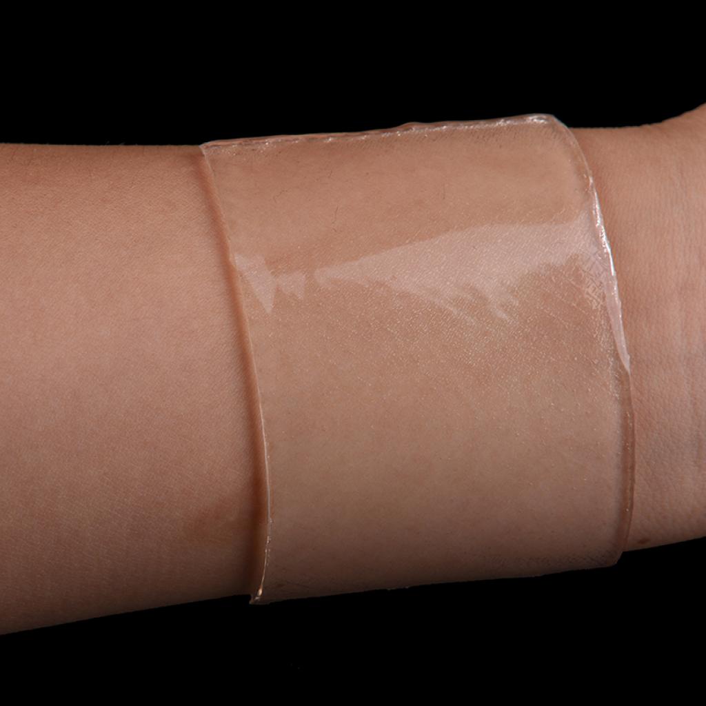 Miếng Dán Silicone Làm Mờ Sẹo Tiện Lợi