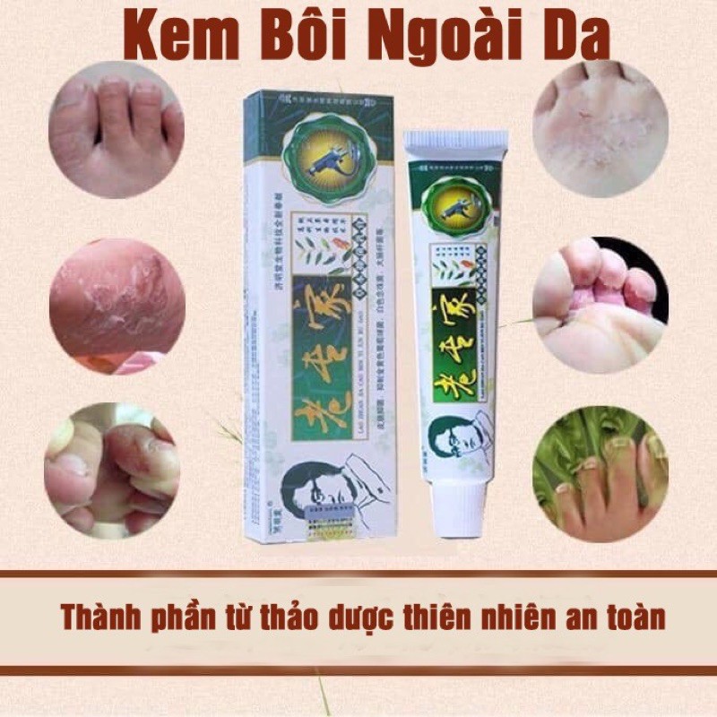 Kem thoa ngoài da (Nấm, nứt nẻ, ngứa, khô da)