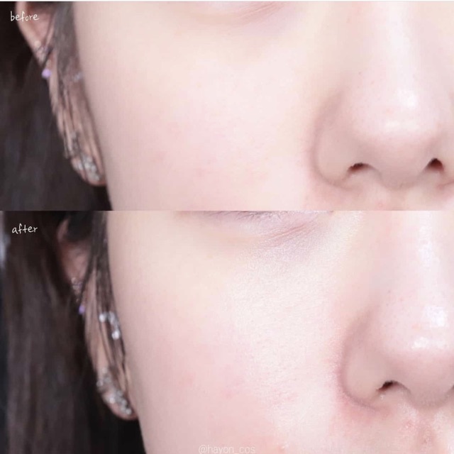 KEM DƯỠNG GIẢM MỤN A’PIEU MADECASSOSIDE CREAM ( TÁCH SET KO CÓ VỎ HỘP ) | BigBuy360 - bigbuy360.vn