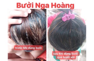 Combo dầu gội bưởi ( lọ to ) + xịt tóc tinh dầu bưởi