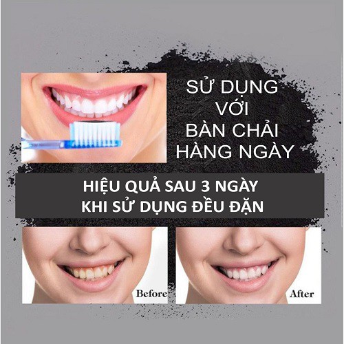 Bộ 3 SP Tẩy Trắng răng tại nhà gồm: Chỉ nha khoa + Bàn chải + Bột than tre hoạt tính làm trắng răng thiên nhiên
