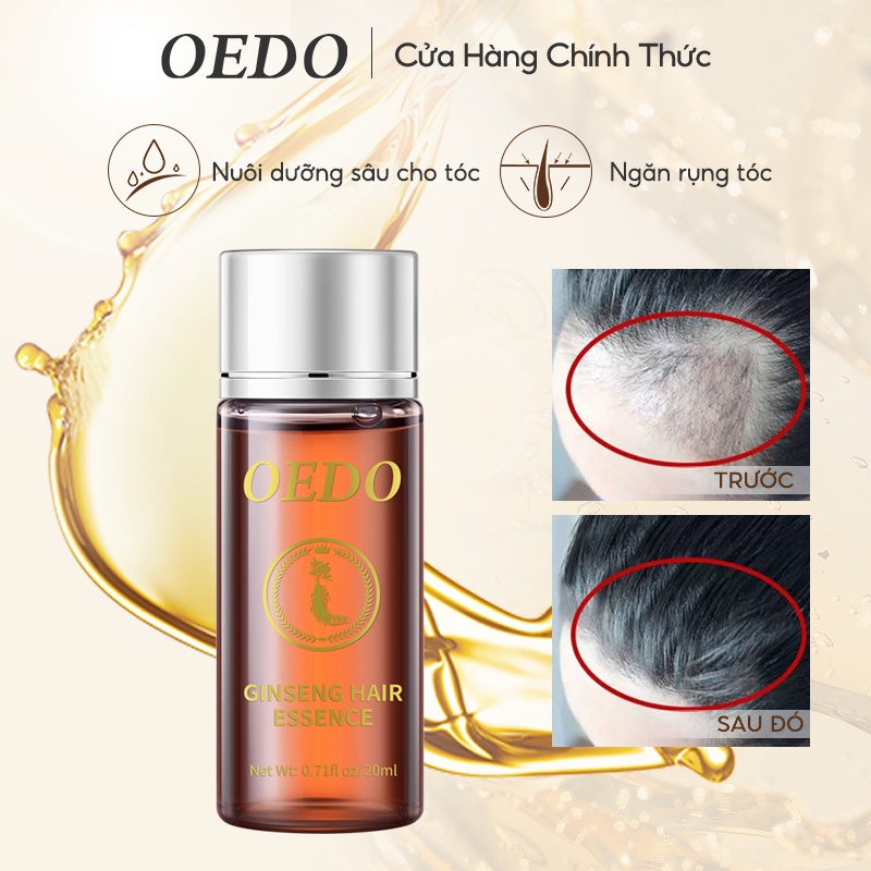 Tinh chất dưỡng tóc nhân sâm OEDO ngăn rụng tóc và giúp mọc tóc phục hồi tóc hư tổn giữ nếp tạo nếp tóc mềm 20ml