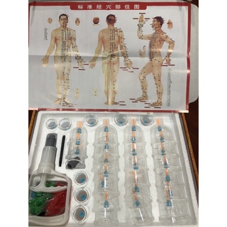 Bộ giác hơi không dùng lửa