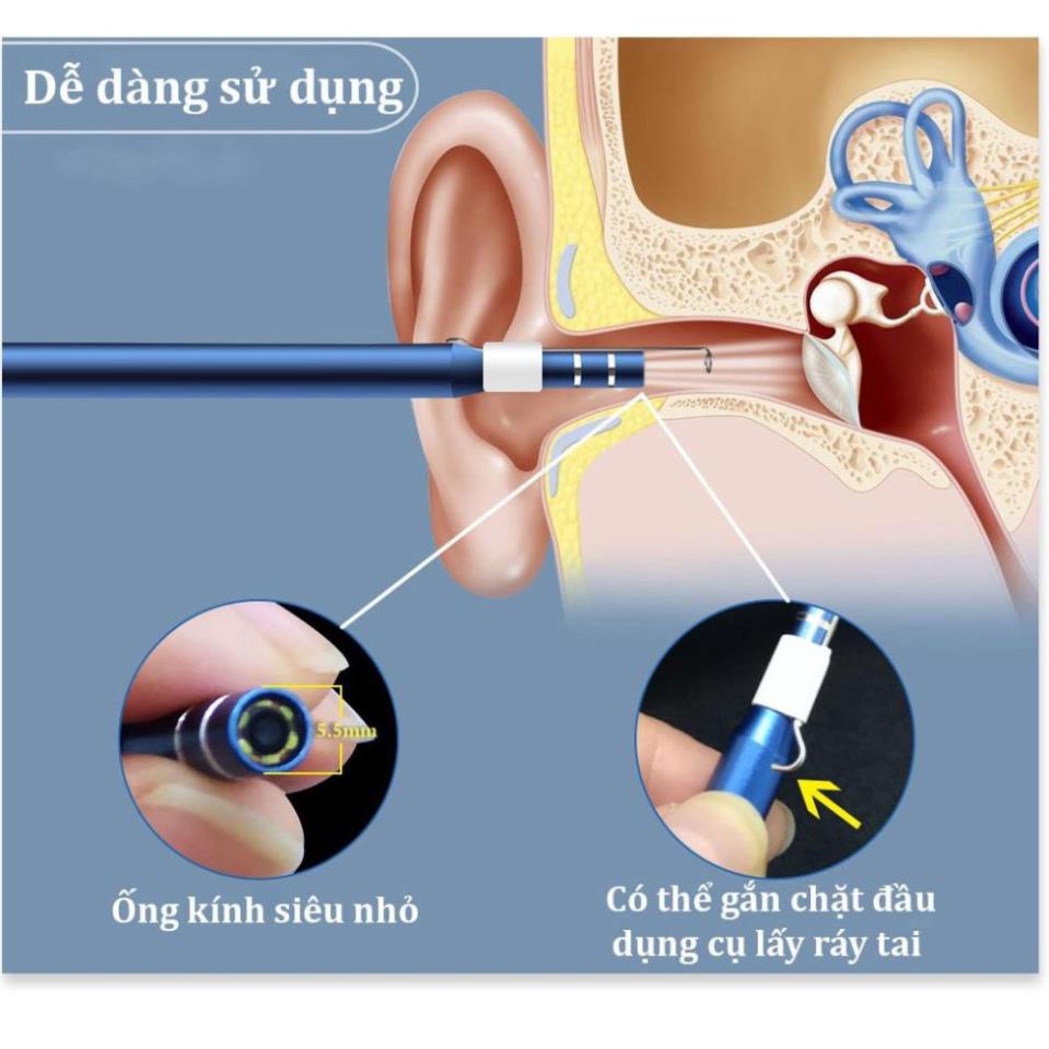 Lấy Ráy Tai camera 3 trong 1,Nội Soi Tai Mũi Họng, Có Kết Nối Với Điện Thoại, Máy Tính