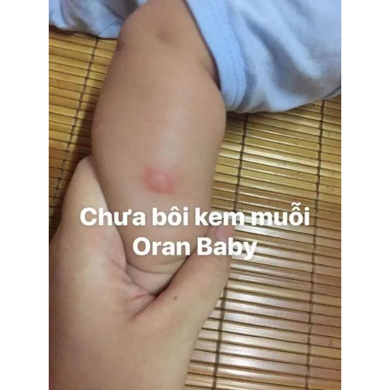 Kem muỗi Oran Baby I'm Nature làm dịu, phục hồi da cho bé