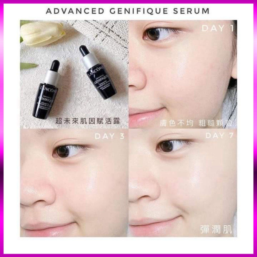 [Mini]Sẵn Serum bi lăn dưỡng mắt 5ml và Serum Lancôme 7ml