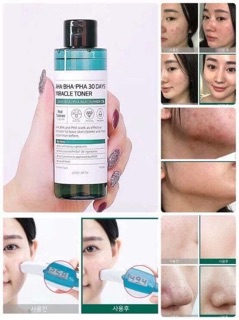 Toner Trị nun AHA - BHA-PHA 30days miracle Toner