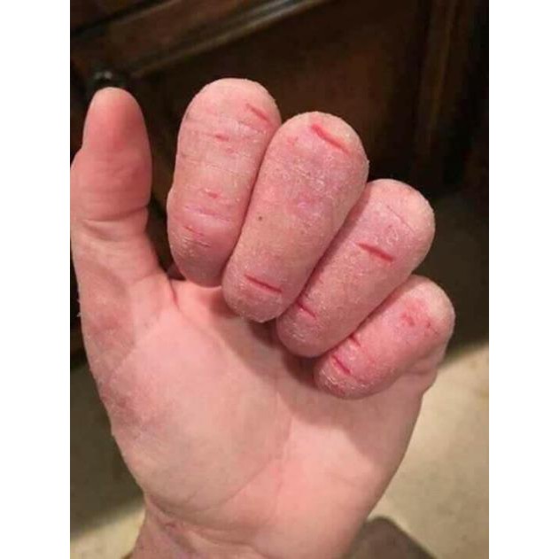 [ XẢ HÀNG ] KEM BÔI ĐÔNG Y TRỊ NỨT CỰC HIỆU QUẢ NẺ SIÊU HÓT | BigBuy360 - bigbuy360.vn