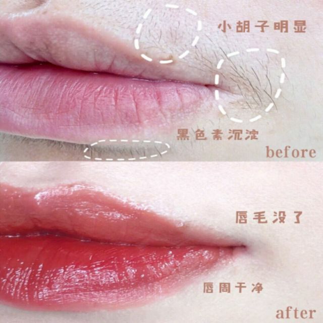 ✨Newfashiongoods✨Cây Lăn Tẩy Lông Mặt Bằng Thép Không Gỉ Tiện Dụng Cho Nữ