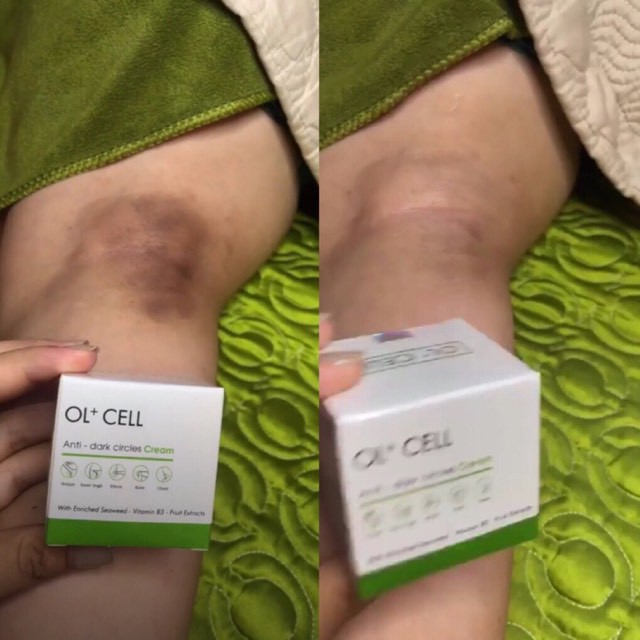 Kem xóa vết thâm thải chì trên da OL-CELL