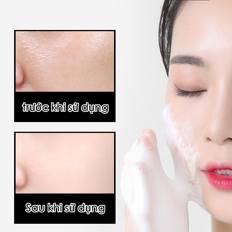 Sữa Rửa Mặt Axit Salicylic Giúp Kiềm Dầu Làm Sạch Và Dưỡng Ẩm Cho Da