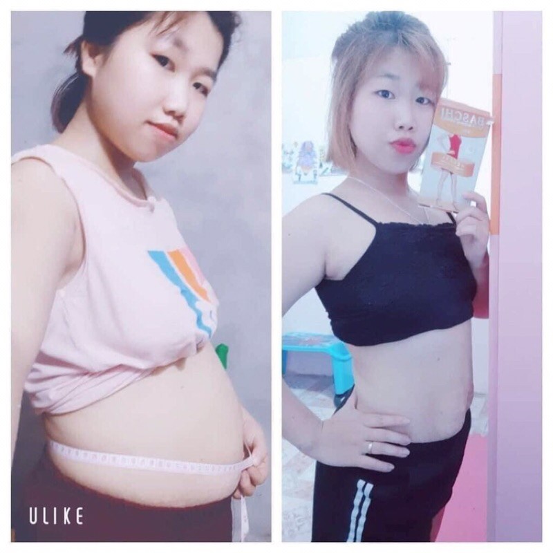 (Chính Hãng) Hỗ trợ Giảm Mỡ Thừa An Toàn 100% Thái Lan Viên uống tinh dầu Hoa Anh Thảo