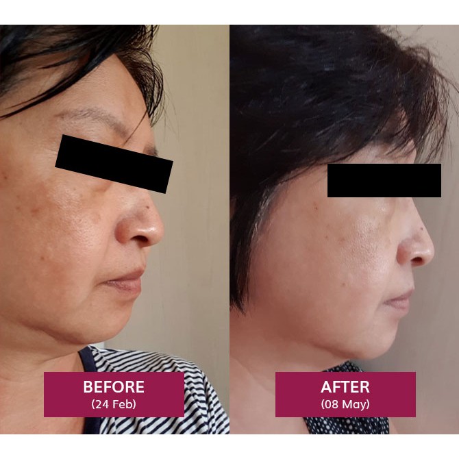 [CAO CẤP] TDF - Kem giảm nám, sáng da TDF Fairence T Complex 30g