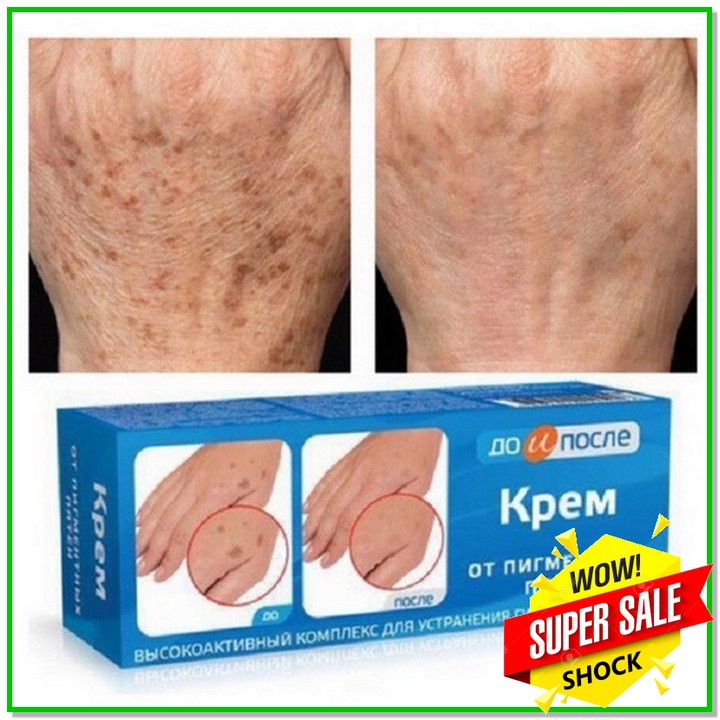 Kem Đồi Mồi Kpem 50ml Nga,⚡️FREESHIP⚡️,Mờ Nhăn Tay, Nám, Tàn Nhan, Dưỡng Da tay