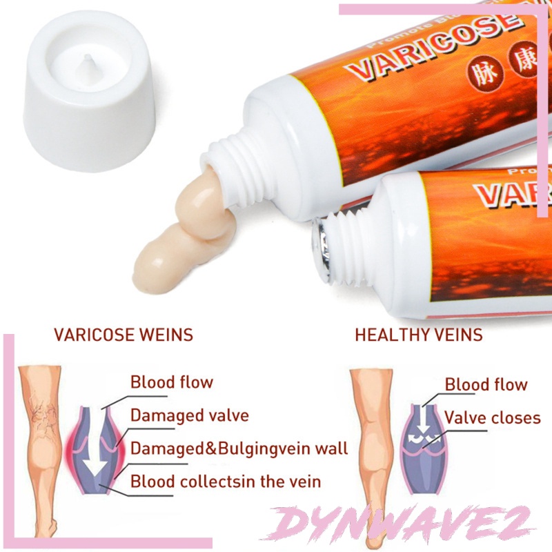 [DYNWAVE2]Ointment Varicose Veins Vasculitis Treatment Cream Foot Heanth Care Gel