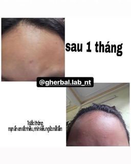 [SALE] bột diếp cá gói lớn