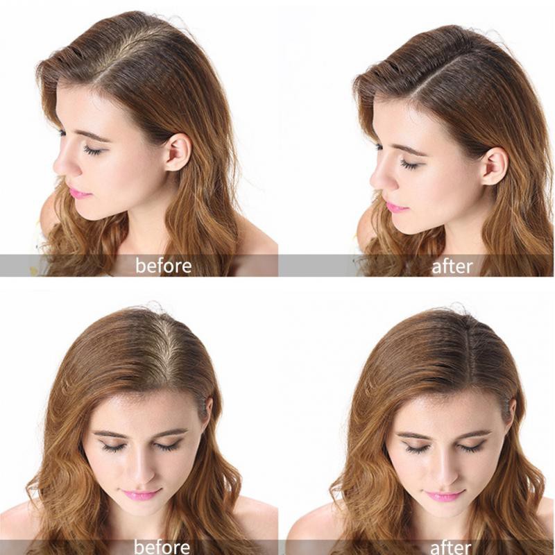 Chai Xịt Kích Thích Mọc Tóc PURC Kiểu Dáng Tiện Dụng 30ML | BigBuy360 - bigbuy360.vn