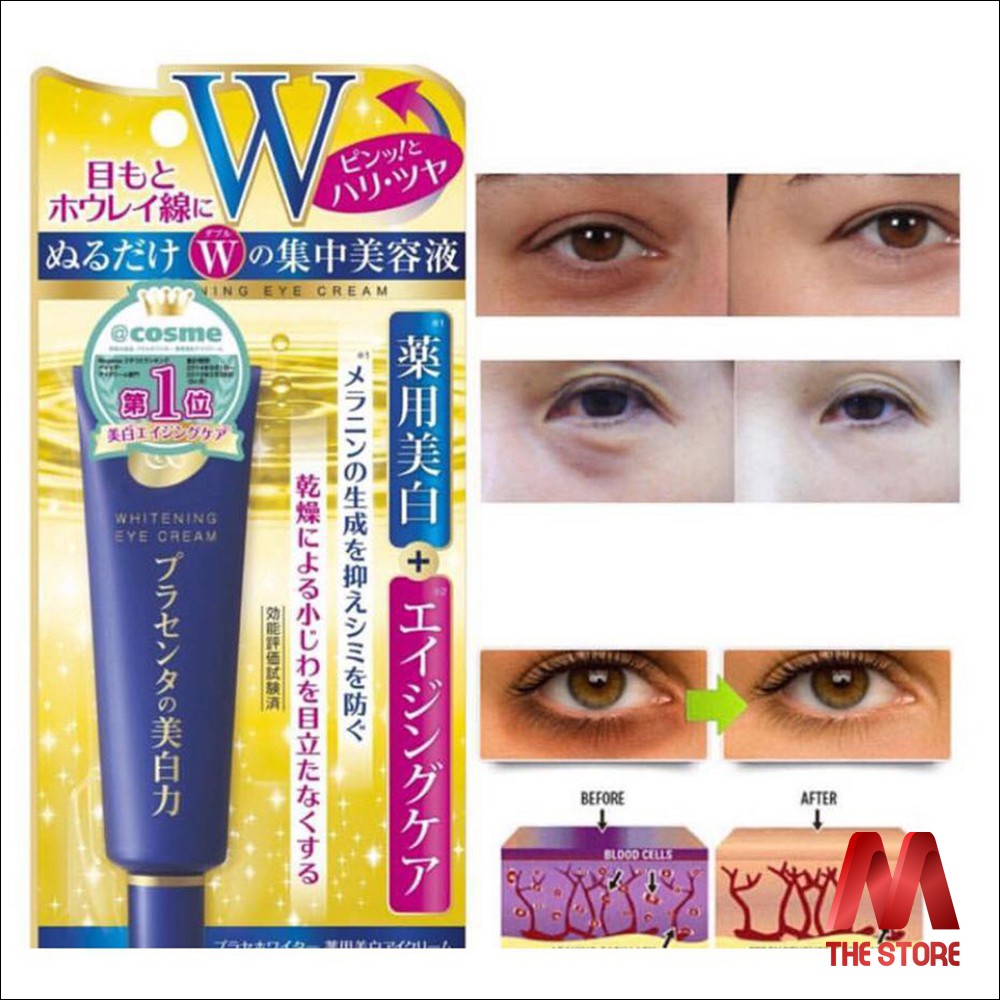 Kem mắt giảm thâm, làm mờ vết nhăn Meishoku Whitening Eye Cream 30g
