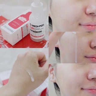 Combo Medipeel Serum Dưỡng Trắng MEDIPEEL Glutathione 600 White Combo Serum Và Kem Dưỡng Medipeel