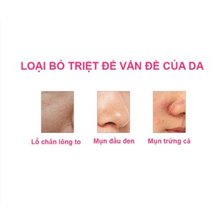 Máy rửa mặt Masage Forever Lina Mini