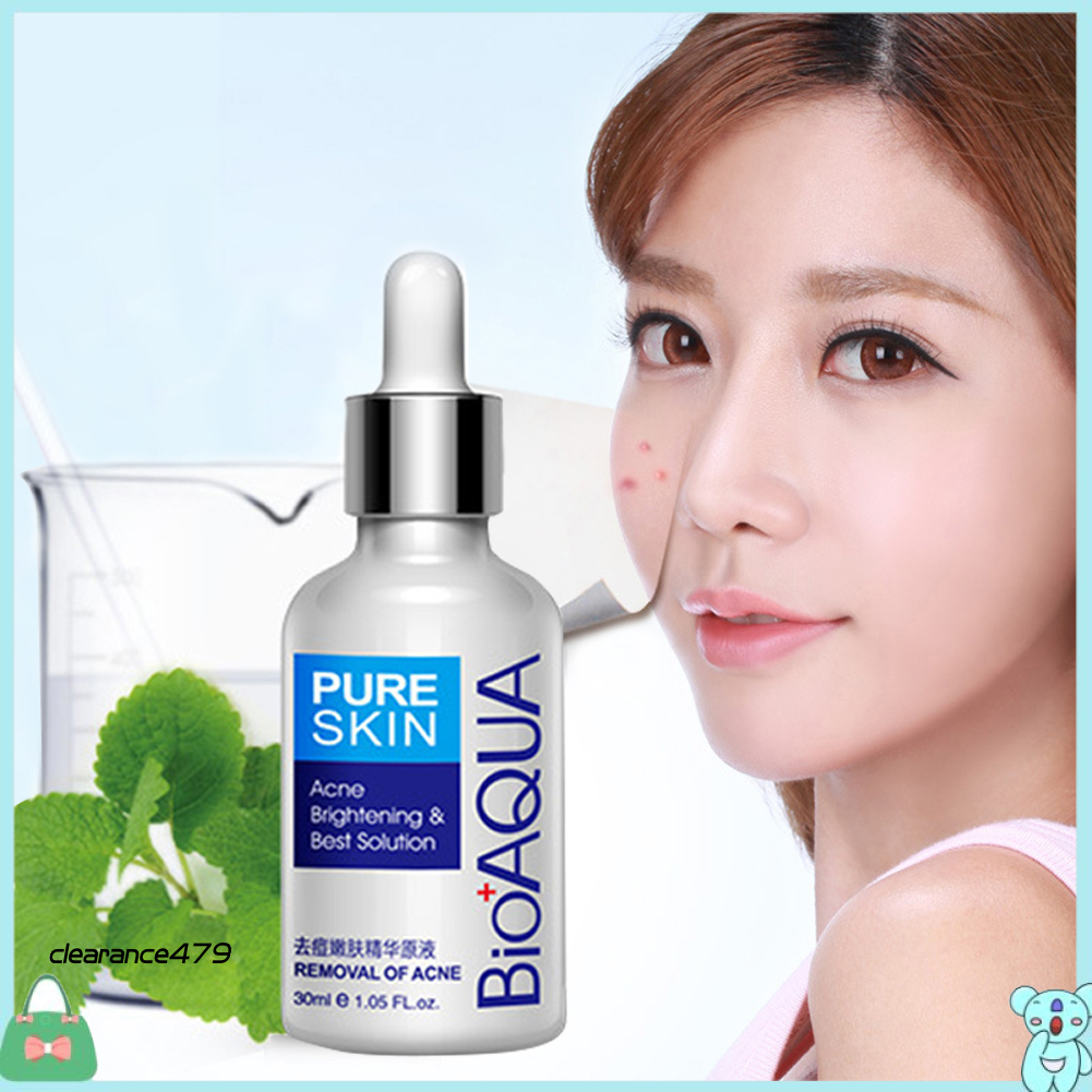 (Hàng Mới Về) Tinh Chất Trị Mụn Kiềm Dầu Dưỡng Ẩm Da Cao Cấp Thương Hiệu Bioaqua 479 Bioaqua 30ml