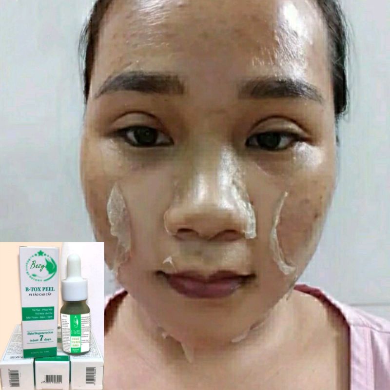 Peel Hút Nám Bong Da Vi Tảo Trắng Da Bezy Cao Cấp