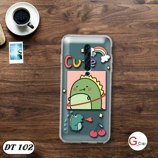 Ốp lưng dẻo OPPO RENO 2F