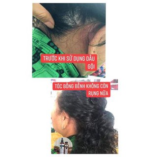 Combo 4 món chăm sóc tóc và phục hồi tóc