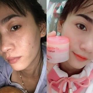 Kem face colagen plus vit E chuẩn indonesia