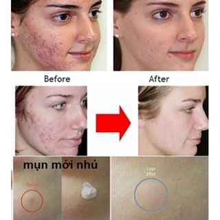 Fullsize 29ml Chấm mụn MARIO BADESCU Drying Lotion