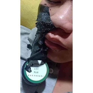 [free ship] lột sạch  mụn cám, đầu đen .(quyên lara)