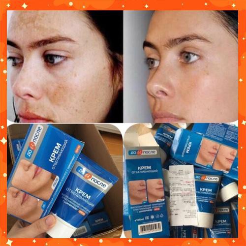 kem nám tàn nhang Kpem Cream mờ nám tàn nhang đ𝐨̂̀𝐢 𝐦𝐨̂̀𝐢 dưỡng da tay dưỡng ẩm da phục hồi da 𝐓𝐚̣̆𝐧𝐠 𝐦𝐚́𝐲 𝐦𝐚𝐬𝐬𝐚𝐠𝐞