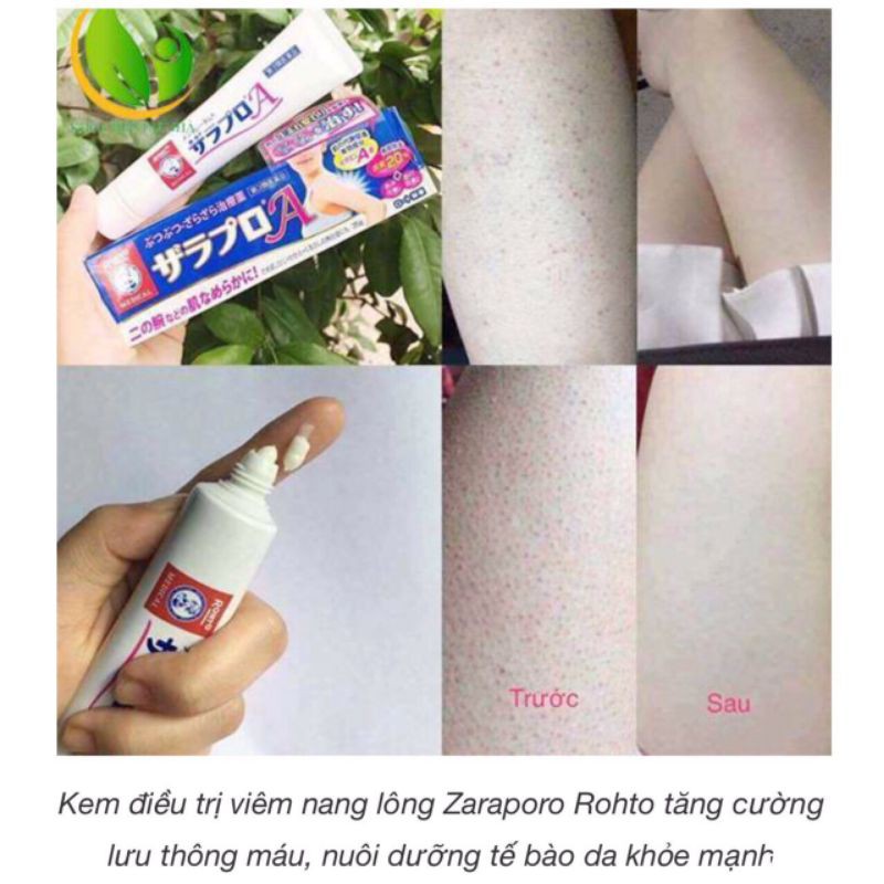 Kem bôi da Viêm Nang Lông Zaraporo Rohto Nhật Bản 35g