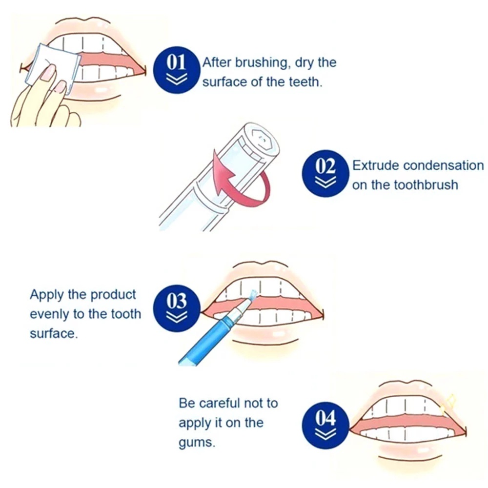 Bút Gel Làm Trắng Răng Loại Bỏ Mảng Bám Và Làm Sạch Răng