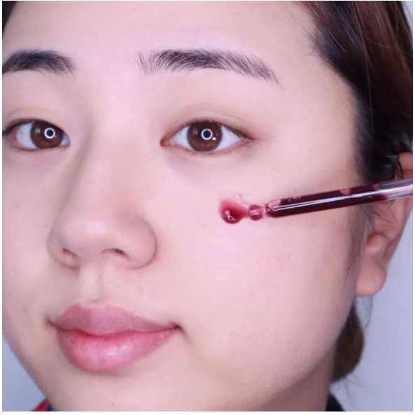 Tinh Chất Tẩy Da Chết Hóa Học So' Natural Red Peel Tingle Serum 35ml | BigBuy360 - bigbuy360.vn