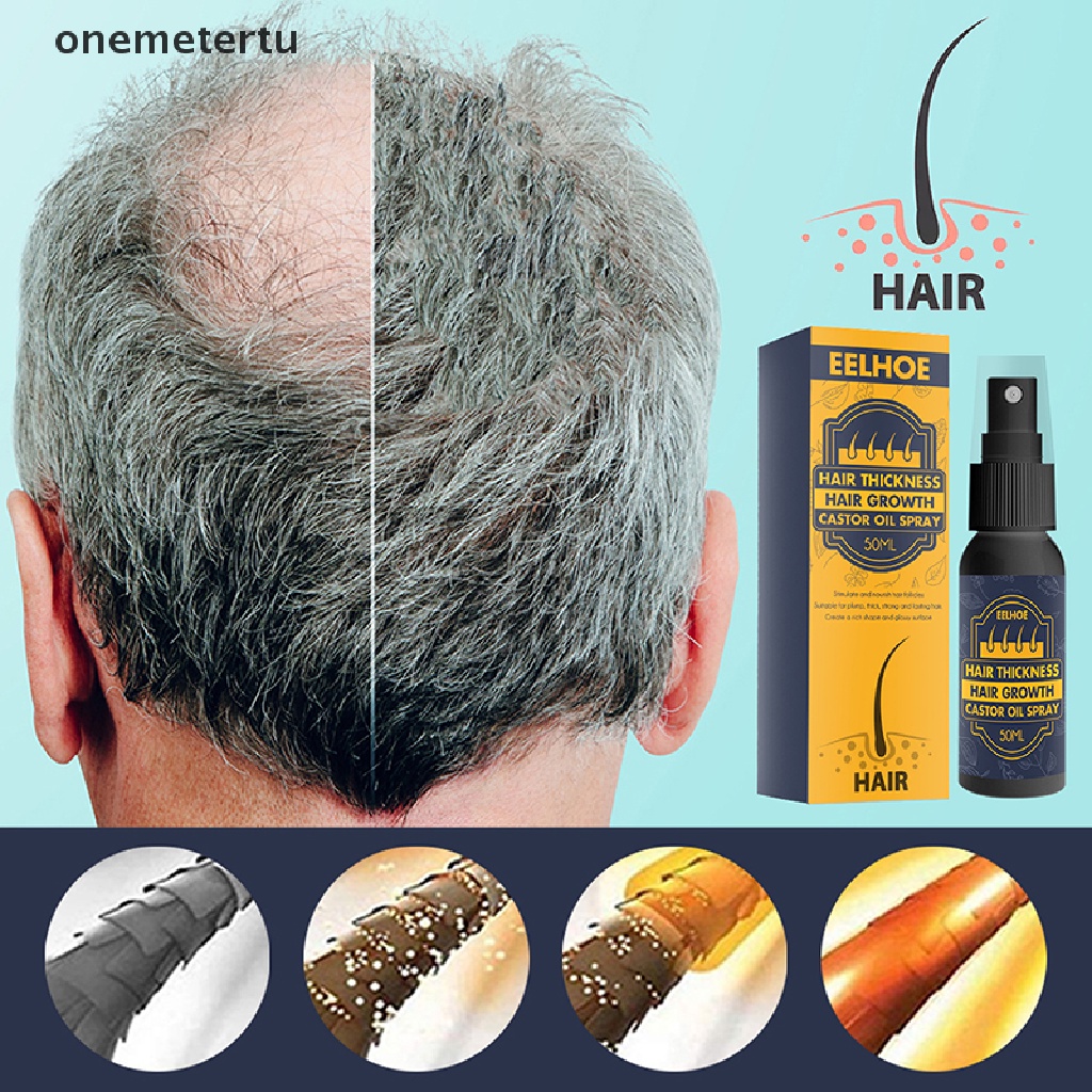 Tinh Dầu Thầu Dầu Kích Thích Mọc Tóc Chống Rụng Tóc onemetertu 50ml