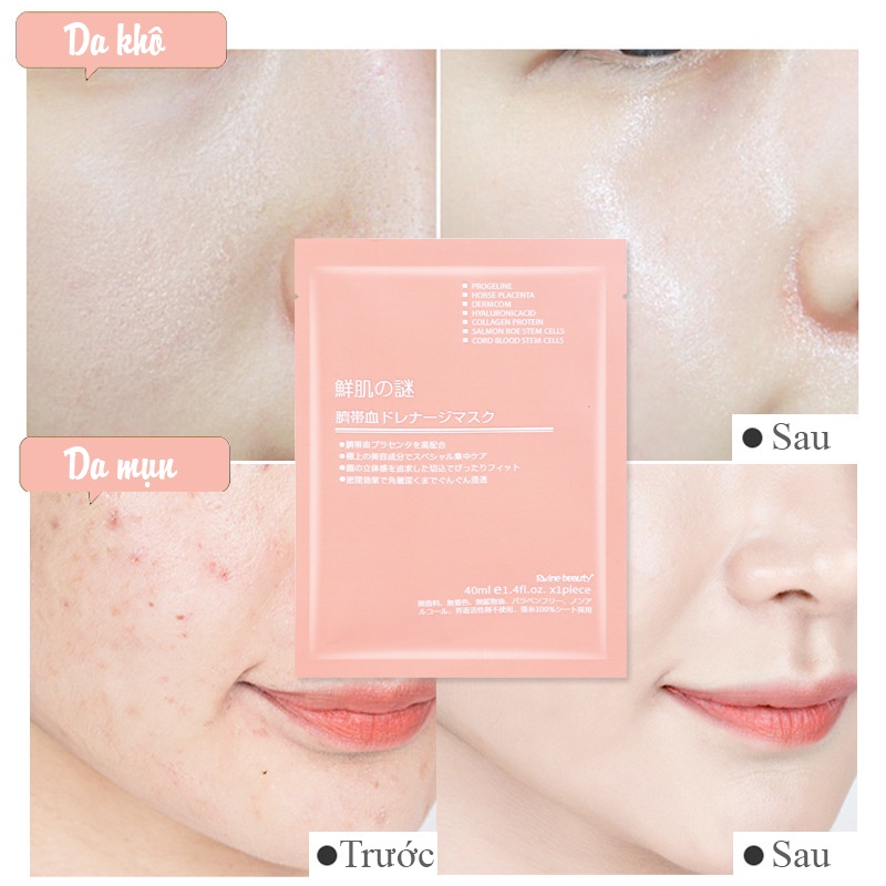 Mặt nạ tế bào gốc nhau thai cừu Rwine Beauty