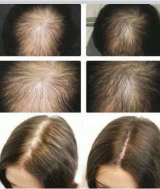 Tinh chất kích thích mọc tóc Sato Nhật Bản 30ml | BigBuy360 - bigbuy360.vn