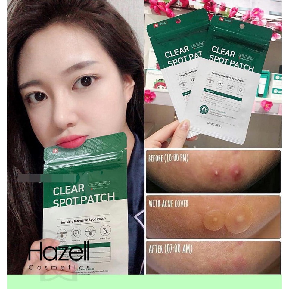 MIẾNG DÁN MỤN SOME BY MI CLEAR SPOT PATCH 18 MIẾNG CHÍNH HÃNG - 4123