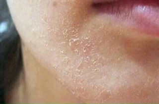 serum Huyền Cò
