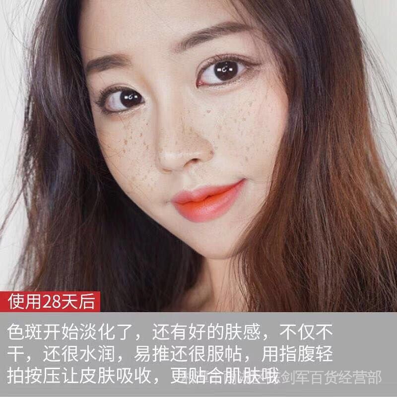 Bộ kem làm trắng xóa thâm đốm sắc tố melanin tàn nhang trẻ hóa da sáng và buổi tối